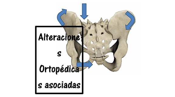 Alteraciones ortopédicas. Un enfoque holístico de la escoliosis.